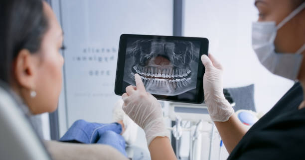Licensed Teeth Whitening service in Pleasant Hill, OH - Smile Center Dentistry